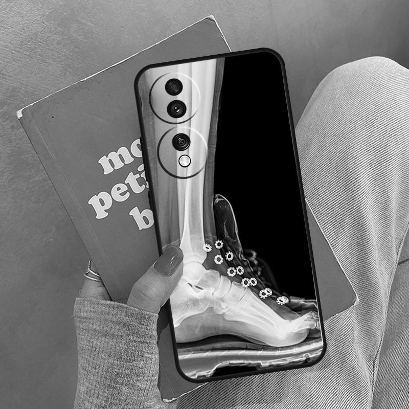 X-Ray Human Anatomy Case For Honor Magic 5 6 7 8 Pro Cover For Honor 200 400 Lite 50 70 90 X8a X8b X9a X9b X9c Honor X8a
X-Ray Human Anatomy Case For Honor Magic 5 6 7 8 Pro Cover For Honor 200 400 Lite 50 70 90 X8a X8b X9a X9b X9c Honor X8a
