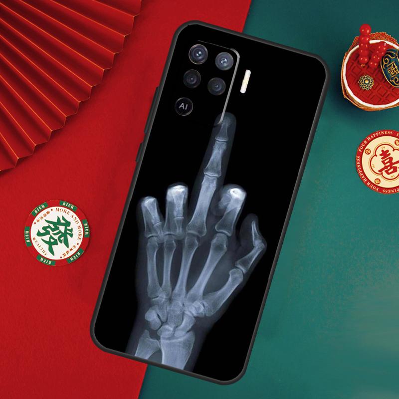 Skeleton Middle Finger Case For Oppo A80 A40 A60 A6 A5 Pro A15 A16 A17 A57 A94 A74 A54 A76 A96 A18 A38 A58 A78 A98 OPPO A74 5G
Skeleton Middle Finger Case For Oppo A80 A40 A60 A6 A5 Pro A15 A16 A17 A57 A94 A74 A54 A76 A96 A18 A38 A58 A78 A98 OPPO A74 5G