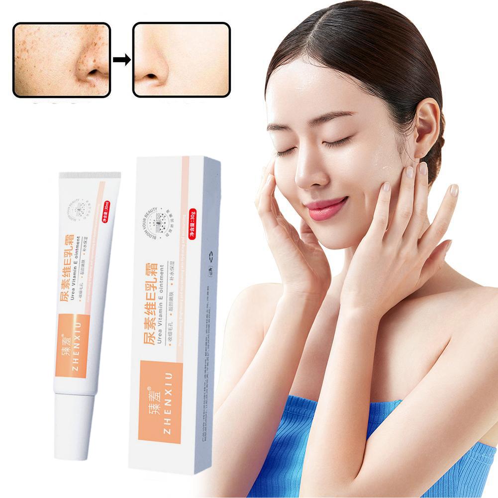 30g Body Whitening Cream Remove Chicken Skin Anti-dry Fade Body Pores Spot Skin Cracking Moistu Z6Q6 yellow-one size
30g Body Whitening Cream Remove Chicken Skin Anti-dry Fade Body Pores Spot Skin Cracking Moistu Z6Q6 yellow-one size