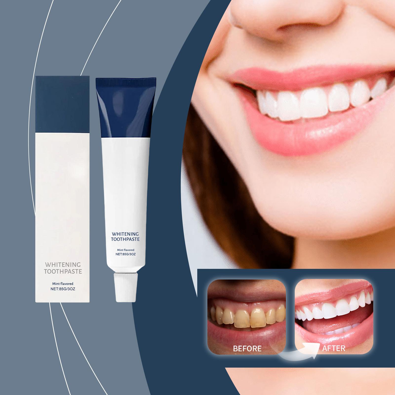 Whitening Mint Toothpaste Safely Reduces Tooth Stains And Tartar, Freshens Breath, Inhibits And Cleans Teeth. One Size білий
Whitening Mint Toothpaste Safely Reduces Tooth Stains And Tartar, Freshens Breath, Inhibits And Cleans Teeth. One Size білий