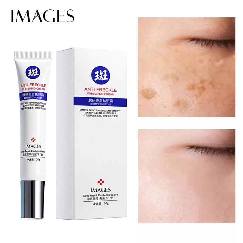 Отбеливающий крем от веснушек для ухода за лицом 20г
Отбеливающий крем от веснушек для ухода за лицом 20г