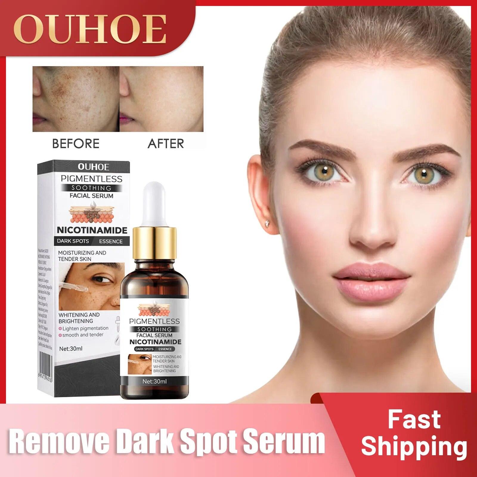 Сыворотка для удаления темных пятен, выцветание пигментации, меланодермия, меланин, корректирующее отбеливание, питание против старения, осветляющая эссенция для веснушек
Сыворотка для удаления темных пятен, выцветание пигментации, меланодермия, меланин, корректирующее отбеливание, питание против старения, осветляющая эссенция для веснушек