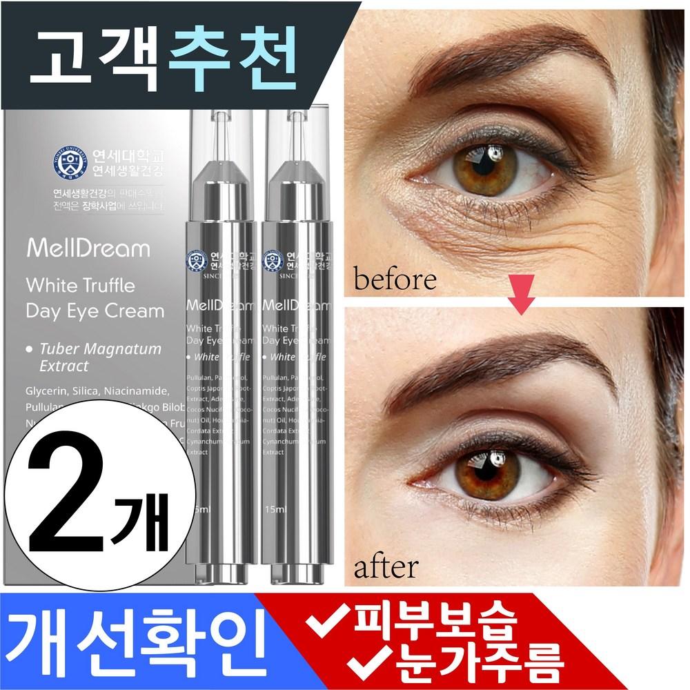 Дневной крем для кожи вокруг глаз Meldream Yonsei University White Truffle Eye Area Moisture Nutrition Eyepalt Eye Bag Day Eye Cream, 15 г, 2 упаковки
Дневной крем для кожи вокруг глаз Meldream Yonsei University White Truffle Eye Area Moisture Nutrition Eyepalt Eye Bag Day Eye Cream, 15 г, 2 упаковки
