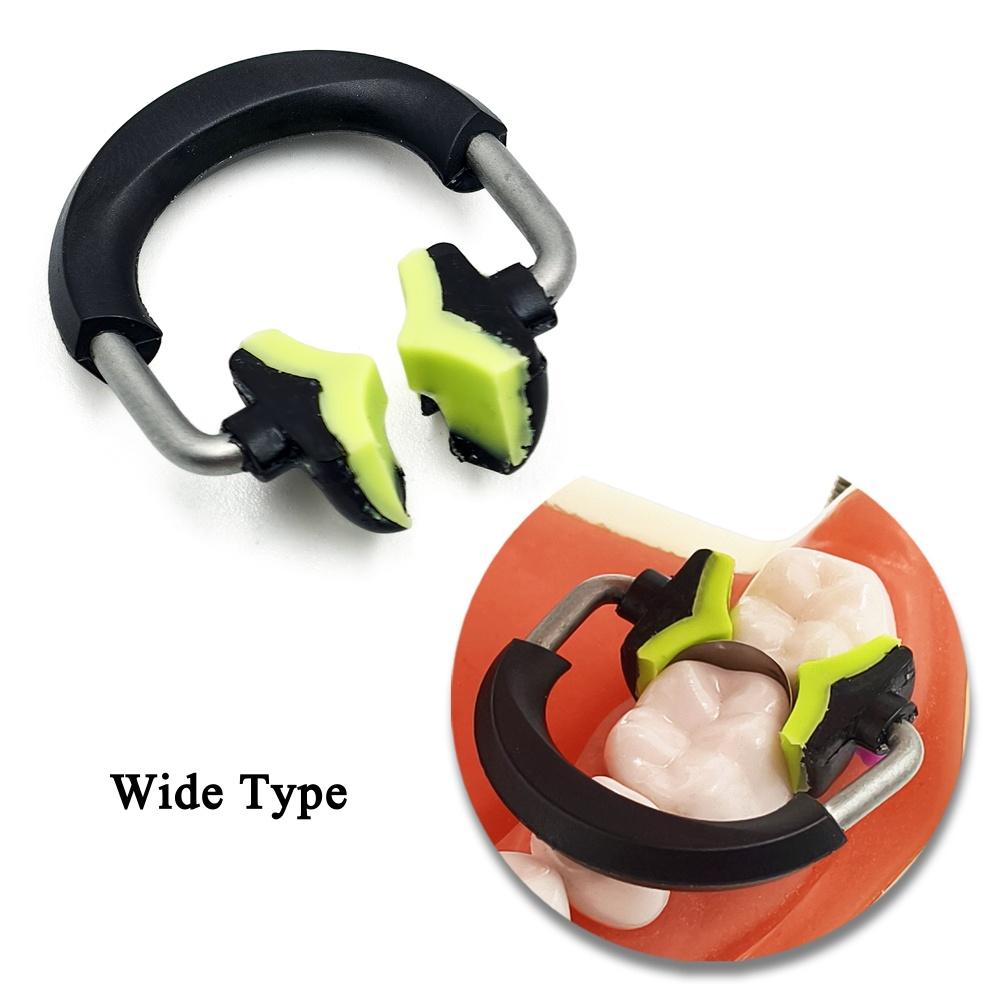 Стоматологические секционные матрицы Зажим Матричная система NITI и PEEK материал Кольцо Матричные ленты Стоматологический инструмент 1 piece Wide
Стоматологические секционные матрицы Зажим Матричная система NITI и PEEK материал Кольцо Матричные ленты Стоматологический инструмент 1 piece Wide