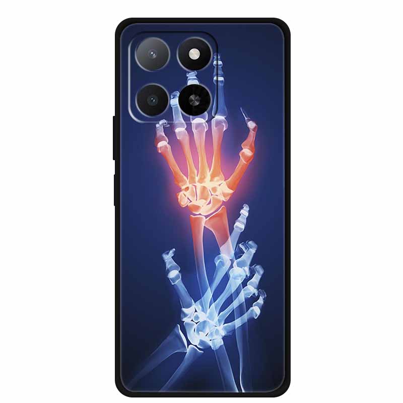 TPU Case For Honor X8C X6B Play 9A X5b Plus X6a X6C Phone Case X 6 8 c 6C 8c a b Coque Flower Black Silicone Soft Back Cover Honor X6a
TPU Case For Honor X8C X6B Play 9A X5b Plus X6a X6C Phone Case X 6 8 c 6C 8c a b Coque Flower Black Silicone Soft Back Cover Honor X6a