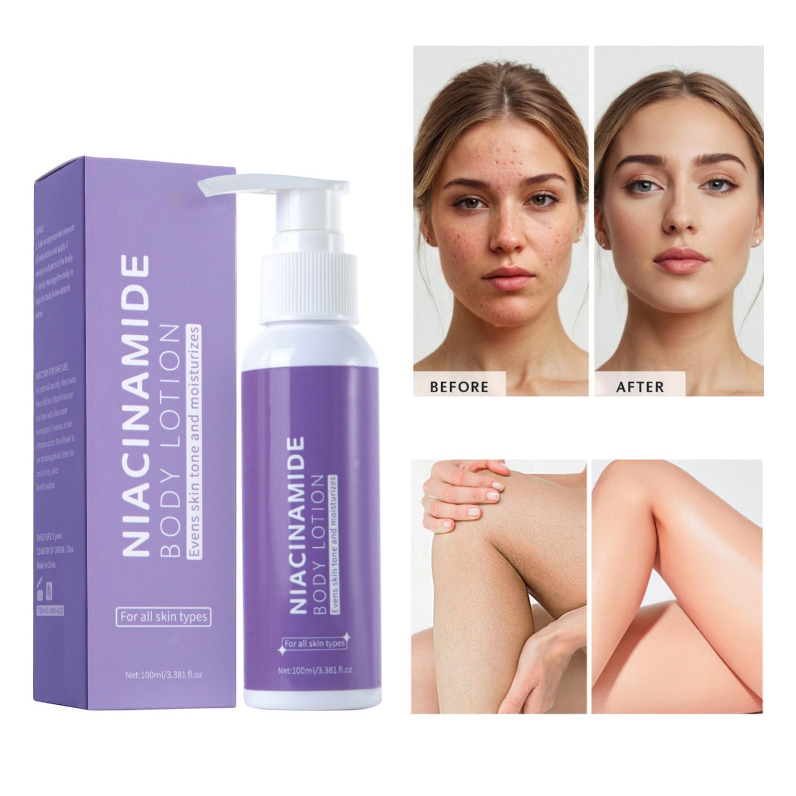 Лосьон для тела с ниацинамидом, отбеливающий и осветляющий, стойкий, делает кожу более сияющей 100 мл
Лосьон для тела с ниацинамидом, отбеливающий и осветляющий, стойкий, делает кожу более сияющей 100 мл