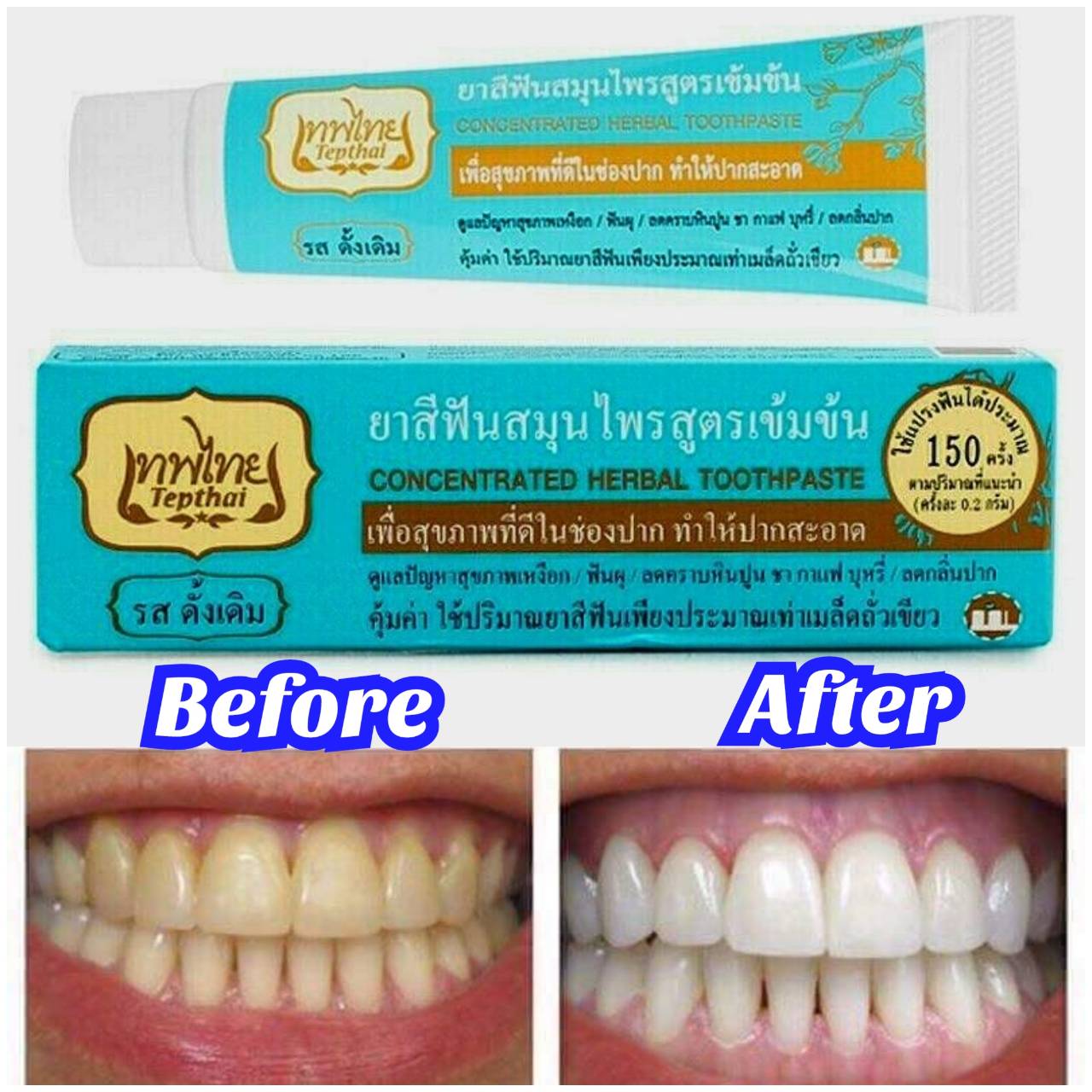 Зубная паста Tepthai Herbal Проблемы с деснами Кариес Уменьшение зубного налета чай кофе 70 г. x1
Зубная паста Tepthai Herbal Проблемы с деснами Кариес Уменьшение зубного налета чай кофе 70 г. x1