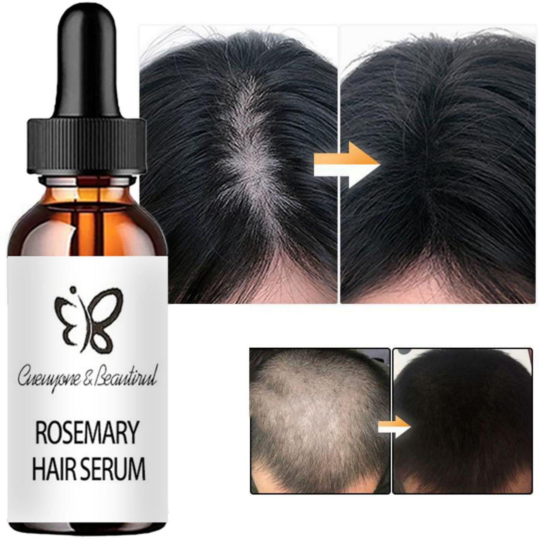 5ML/15ML/30ML/50ML/Rosemary Hair Serum and other OILS for Hair Growth and Nourishment Hair Grower
5ML/15ML/30ML/50ML/Rosemary Hair Serum and other OILS for Hair Growth and Nourishment Hair Grower
