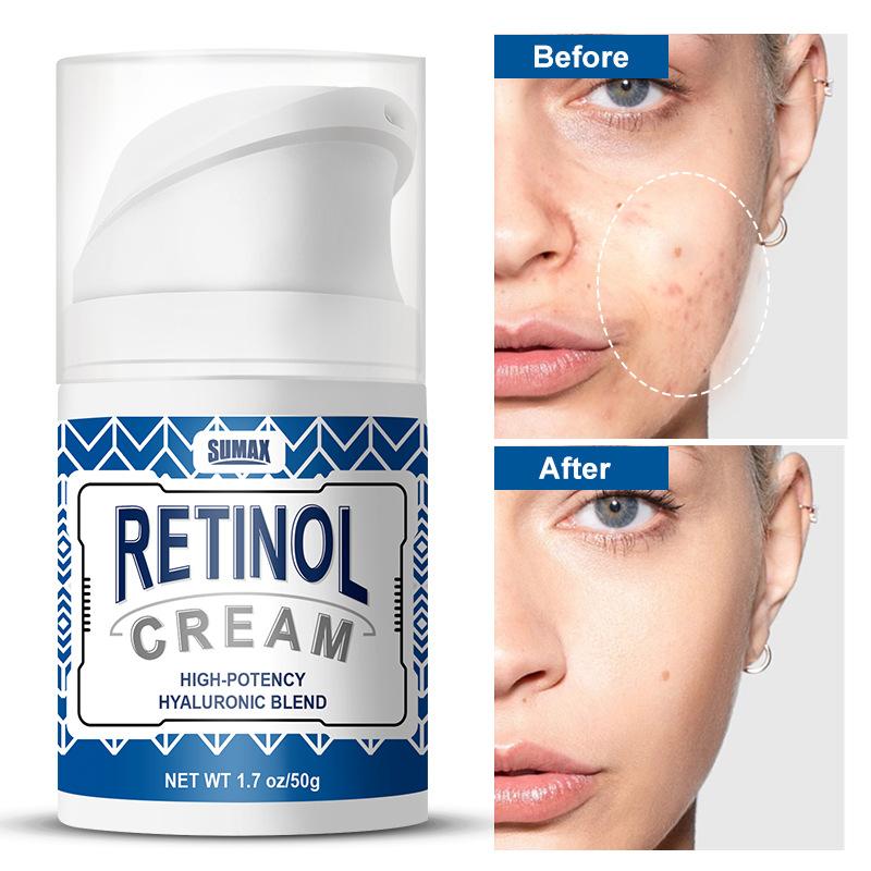 Pressed Retinol Face Cream 50ml Mooth Delicate Radiant and Translucent Rapid Absorption of Skin Retinol Anti Aging Serum 1 bottle
Pressed Retinol Face Cream 50ml Mooth Delicate Radiant and Translucent Rapid Absorption of Skin Retinol Anti Aging Serum 1 bottle