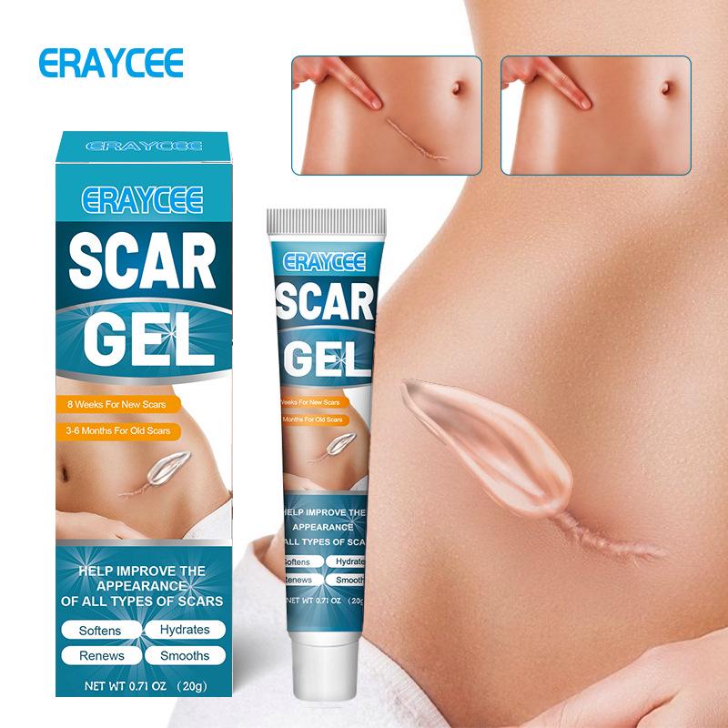 ERAYCEE Scar Fading Gel: Lightens Scars & Burned Areas, Ideal for Post-Delivery Skin Care Standard Size
ERAYCEE Scar Fading Gel: Lightens Scars & Burned Areas, Ideal for Post-Delivery Skin Care Standard Size