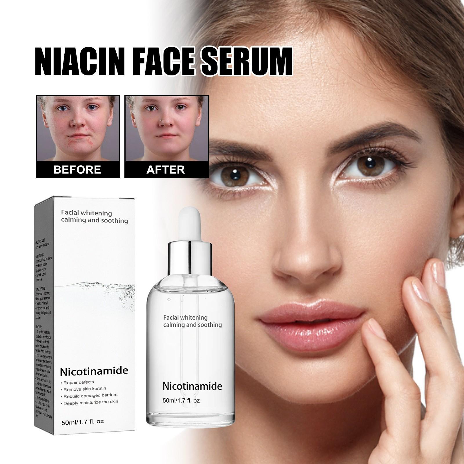 Freckles Removal Serum, Serum For Face And Body, Freckles Removal, Hydrating And Moisturizing Facial For All Type Skin 50ML One Size
Freckles Removal Serum, Serum For Face And Body, Freckles Removal, Hydrating And Moisturizing Facial For All Type Skin 50ML One Size