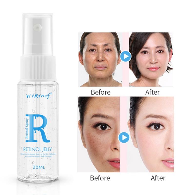 Ретинол-желе-спрей, увлажняющий, укрепляющий кожу, гладкие тонкие линии, осветляющий цвет кожи, антивозрастная эссенция для лица
Ретинол-желе-спрей, увлажняющий, укрепляющий кожу, гладкие тонкие линии, осветляющий цвет кожи, антивозрастная эссенция для лица