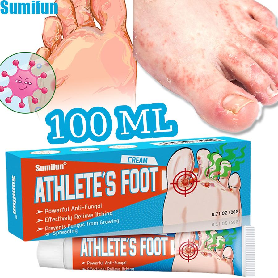 Sumifun 20/40/100 мл Крем для облегчения зуда стоп Уменьшает запах пота на ногах Шелушение Решает дискомфорт при микозе стопы Бактериостатическая мазь 1PC
Sumifun 20/40/100 мл Крем для облегчения зуда стоп Уменьшает запах пота на ногах Шелушение Решает дискомфорт при микозе стопы Бактериостатическая мазь 1PC