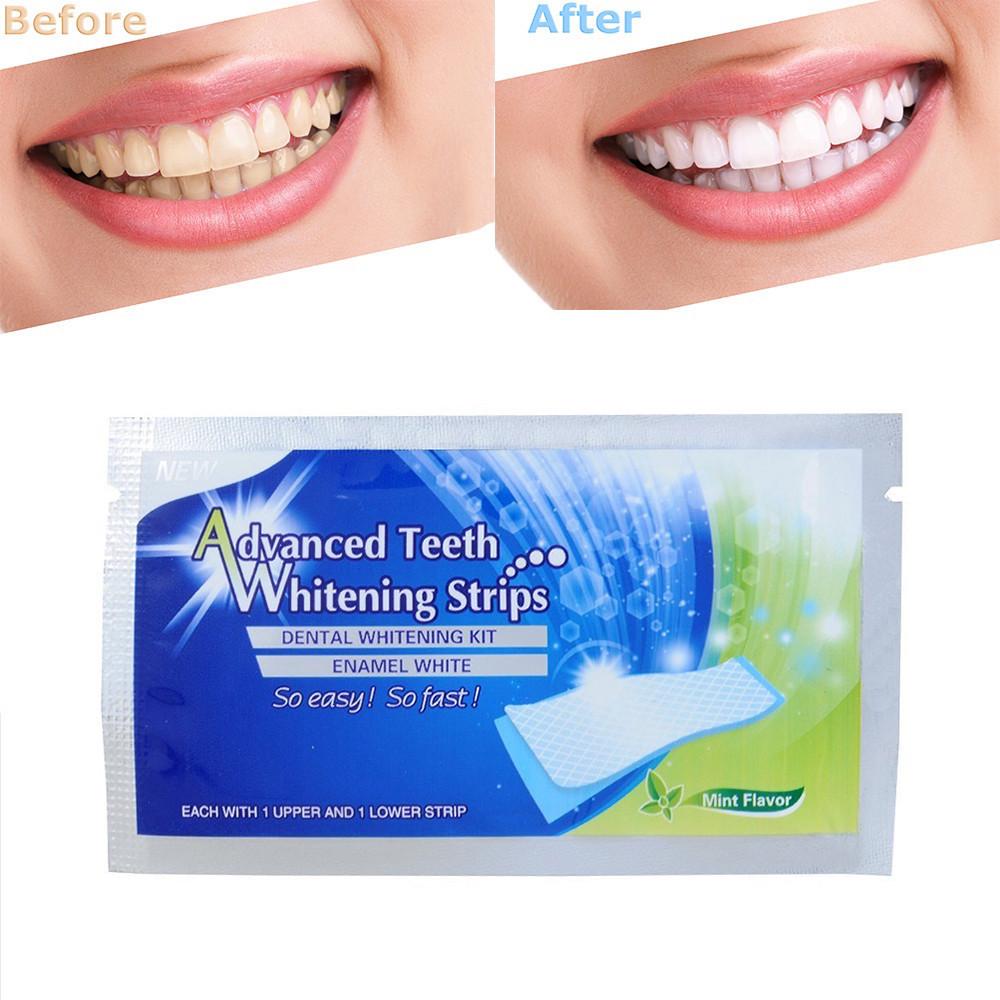 2шт про отбеливание зубов полоски отбеливание отбеливания Whitestrips устные зубов Уход
2шт про отбеливание зубов полоски отбеливание отбеливания Whitestrips устные зубов Уход