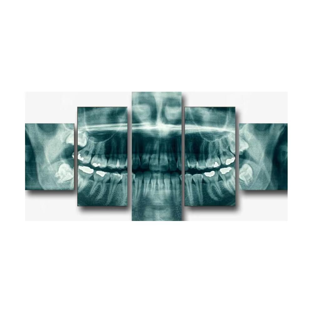 5 Piece Dental teeth XRay Dentist Canvas Painting Wall Art Print Poster Home Decor Print Pictures No Framed 5 Panel Room Decor 20x35-20x45-20x55cm
5 Piece Dental teeth XRay Dentist Canvas Painting Wall Art Print Poster Home Decor Print Pictures No Framed 5 Panel Room Decor 20x35-20x45-20x55cm