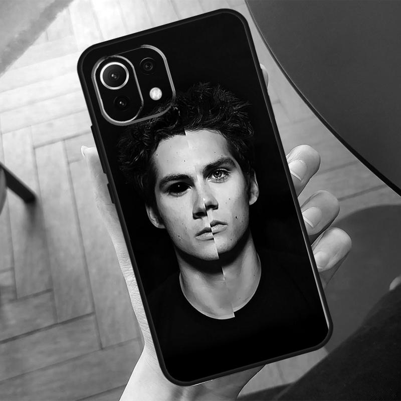 Teen Wolf Case For POCO X3 X5 X6 F6 Pro M6 M5s F3 F5 Xiaomi 13T Pro 11T 12T 12 Lite 13 14 Ultra Cover Xiaomi 13
Teen Wolf Case For POCO X3 X5 X6 F6 Pro M6 M5s F3 F5 Xiaomi 13T Pro 11T 12T 12 Lite 13 14 Ultra Cover Xiaomi 13