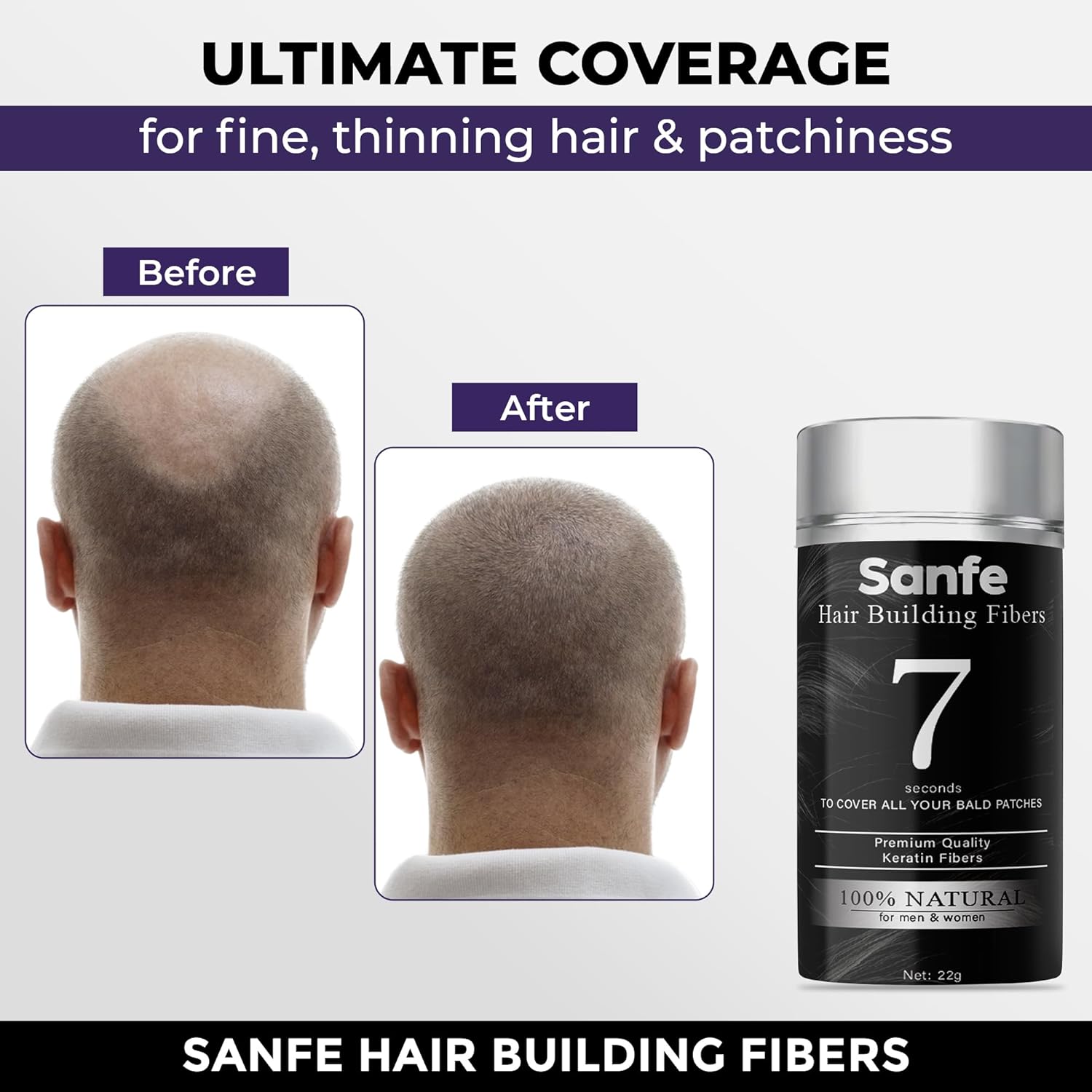 Instant Bald Spot Covering Fibers (22g) | For Fine and Thinning Hair for an Instantly Thicker & Fuller Look - Best Value & Superior Formula | Black 22 GM
Instant Bald Spot Covering Fibers (22g) | For Fine and Thinning Hair for an Instantly Thicker & Fuller Look - Best Value & Superior Formula | Black 22 GM