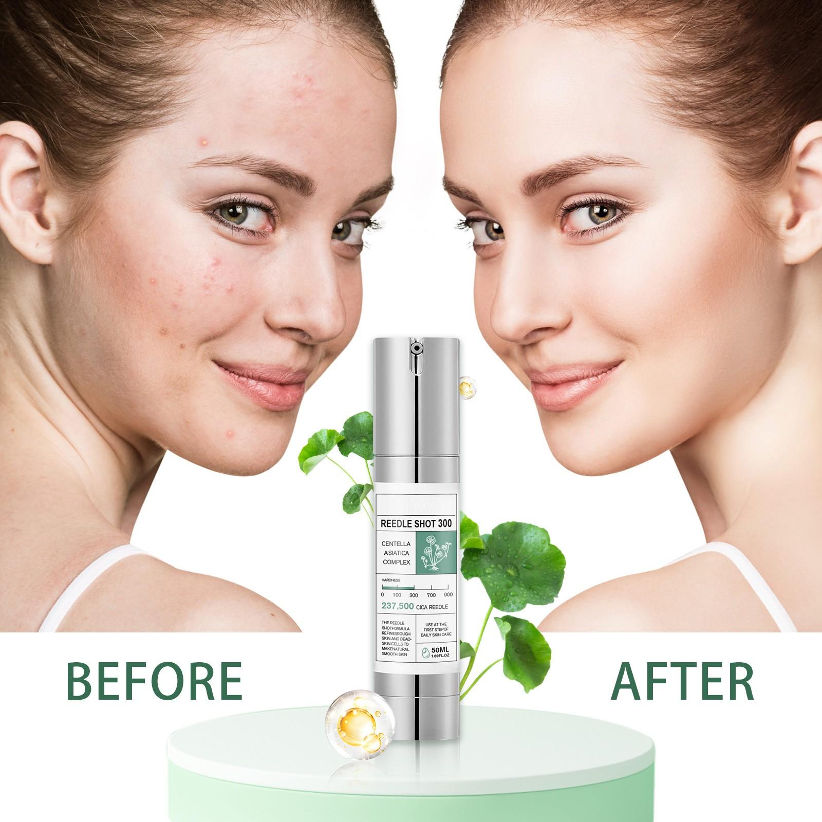 Центелла Увлажняет кожу лица Увлажняющий уход за кожей 50мл 
Центелла Увлажняет кожу лица Увлажняющий уход за кожей 50мл