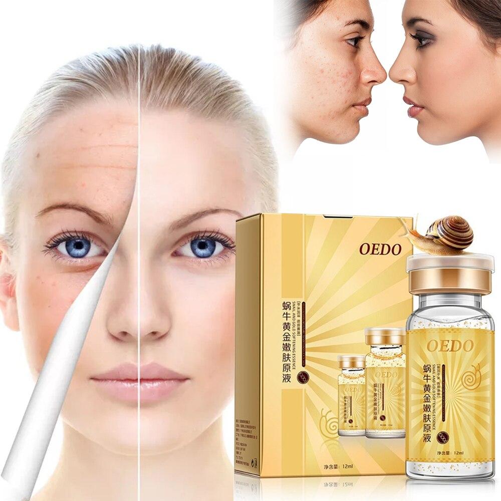 OEDO Snail 24K Gold Сыворотка против морщин, питательная, улучшенная эссенция от прыщей, тонкая линия, антивозрастная, прочная, разглаживающая кожа, уход за лицом
OEDO Snail 24K Gold Сыворотка против морщин, питательная, улучшенная эссенция от прыщей, тонкая линия, антивозрастная, прочная, разглаживающая кожа, уход за лицом