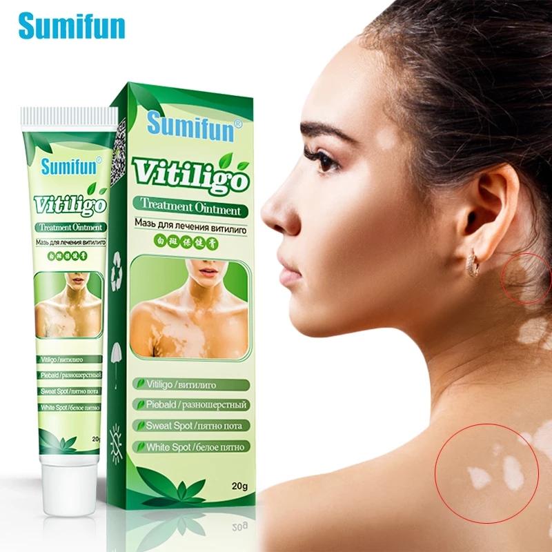 Sumifun Treatment Ointment Leukoplakia White Spot Skin Repair Cream Pigment Melanin Plaster
Sumifun Treatment Ointment Leukoplakia White Spot Skin Repair Cream Pigment Melanin Plaster