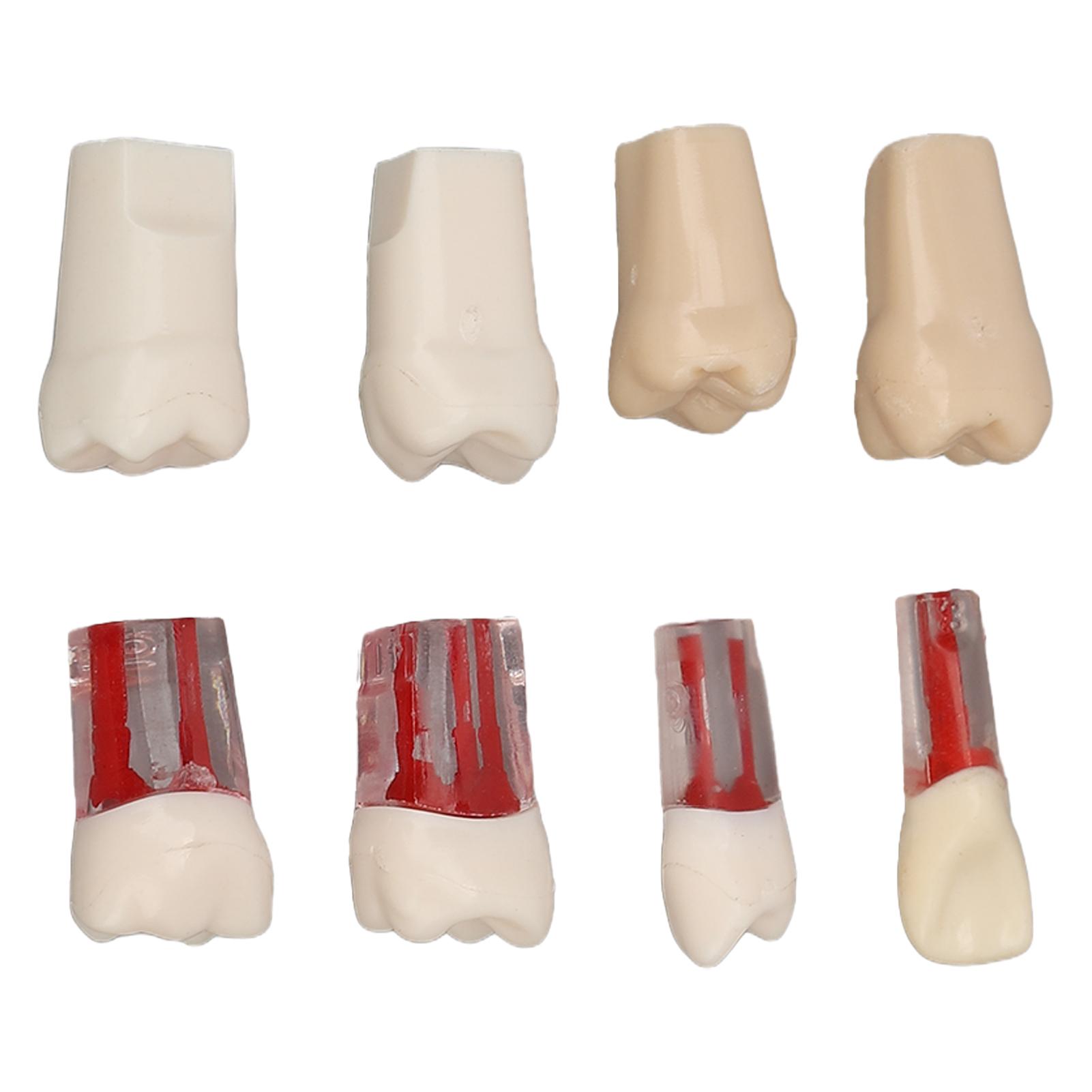 8pcs Canal Root Teeth Model Resin Realistic Demonstration Endodontic Canal Root Teeth for Student
8pcs Canal Root Teeth Model Resin Realistic Demonstration Endodontic Canal Root Teeth for Student
