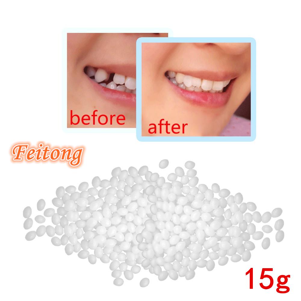 Feitong 15g Временный ремонт зубов Kit Зубы и пробелы FalseTeeth твердый клей дентурный клей клей
Feitong 15g Временный ремонт зубов Kit Зубы и пробелы FalseTeeth твердый клей дентурный клей клей