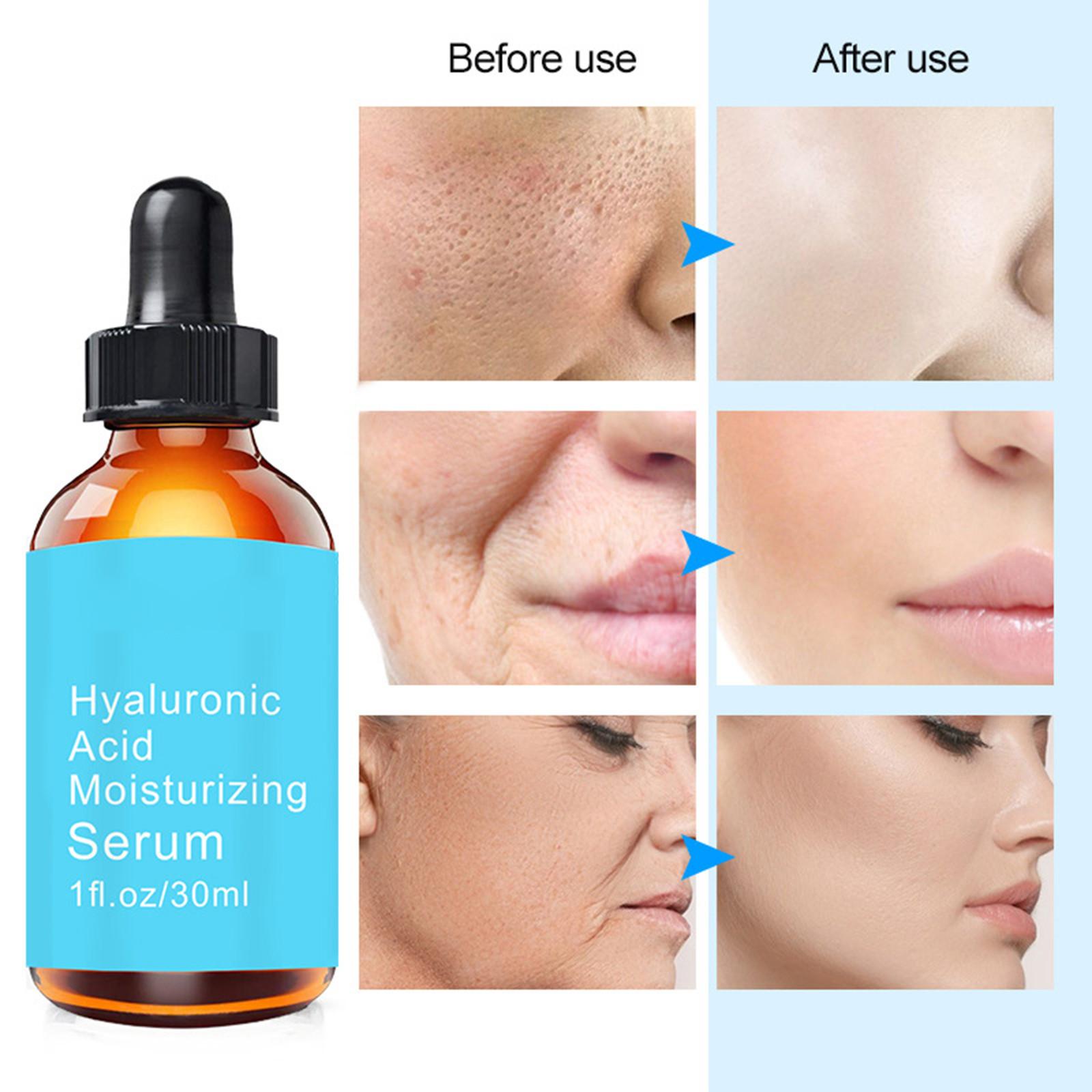 Hyaluronic Serum For Aging Face, Fine Lines, Dark Spots And Dry Skin, Moisturizing Face Serum, Best Face Serum For Hydration 30ml
Hyaluronic Serum For Aging Face, Fine Lines, Dark Spots And Dry Skin, Moisturizing Face Serum, Best Face Serum For Hydration 30ml