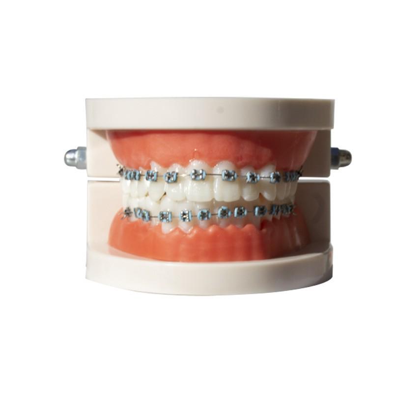 Multi-colored Metal Dental Braces Model for Outpatient Teaching and Practice Display
Multi-colored Metal Dental Braces Model for Outpatient Teaching and Practice Display