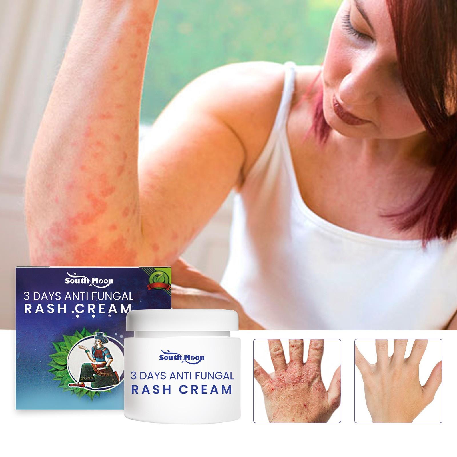 Экзематоидная паста, натуральная паста для внешней кожи, натуральный растительный мох для рук и ног, успокаивает зуд, отек One Size
Экзематоидная паста, натуральная паста для внешней кожи, натуральный растительный мох для рук и ног, успокаивает зуд, отек One Size