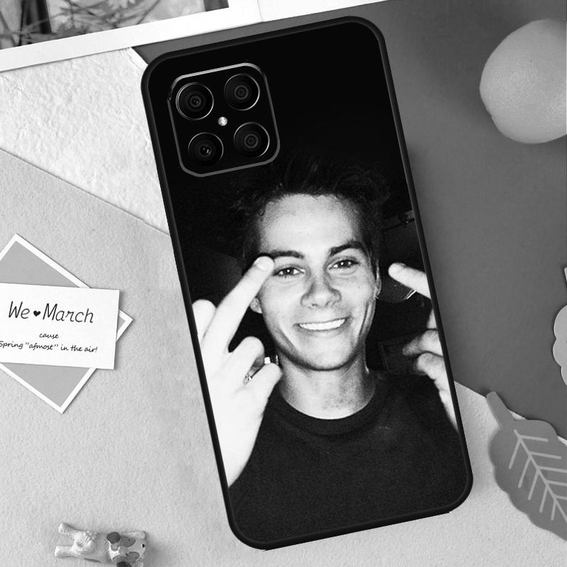 Dylan O Brien Teen Wolf Case For Honor 200 Lite 50 70 90 X9b X9a X8b X8a X8 X9 X9c Honor Magic 7 Pro 5 6 Lite Cover Honor X8 5G
Dylan O Brien Teen Wolf Case For Honor 200 Lite 50 70 90 X9b X9a X8b X8a X8 X9 X9c Honor Magic 7 Pro 5 6 Lite Cover Honor X8 5G