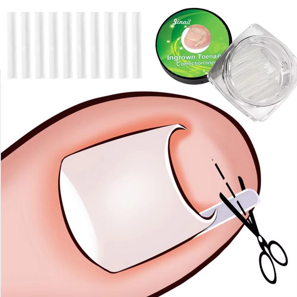 Elastic C-shaped Nail Groove Pad Transparent Pedicure Tool New Ingrown Toenail Correction Tool 10PCS/Box
Elastic C-shaped Nail Groove Pad Transparent Pedicure Tool New Ingrown Toenail Correction Tool 10PCS/Box