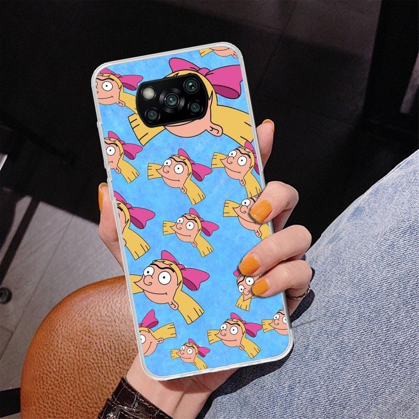 Cartoon Hey Arnold Fondos Phnoe Case for Xiaomi Poco X5 X6 X7 Pro X4 Gt F7 Ultra M8 M7 Redmi 15C 15 13C 13 12C 12 Unique Cover C Xiaomi Poco M7 4G
Cartoon Hey Arnold Fondos Phnoe Case for Xiaomi Poco X5 X6 X7 Pro X4 Gt F7 Ultra M8 M7 Redmi 15C 15 13C 13 12C 12 Unique Cover C Xiaomi Poco M7 4G
