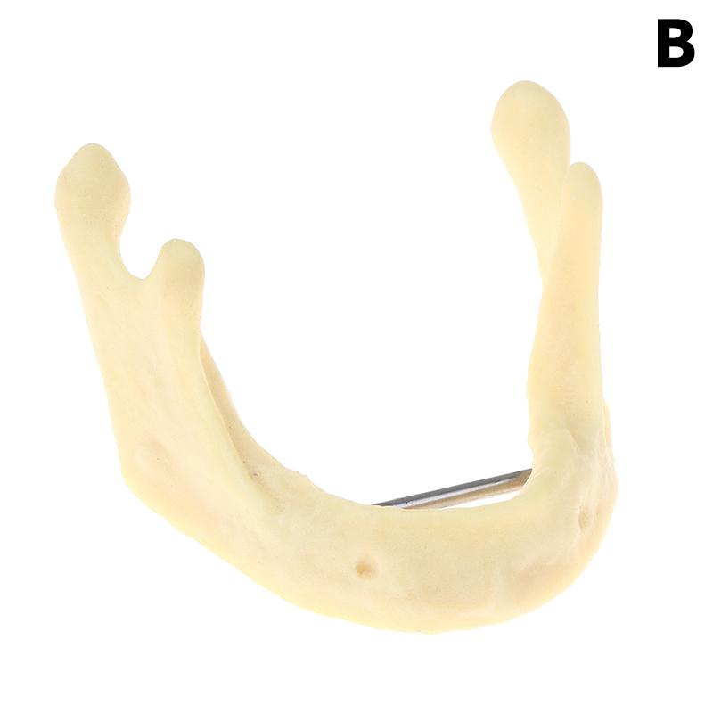 Dental Treatment Model Anatomy Of Gums Gingiva Mandible Tissue Model Dentist Teach Study Demonstration Teeth Model Dental Lab as the picture
Dental Treatment Model Anatomy Of Gums Gingiva Mandible Tissue Model Dentist Teach Study Demonstration Teeth Model Dental Lab as the picture