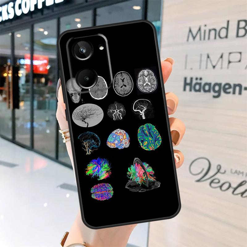 Медицинский Человеческие Органы Мозг Чехол Для Realme 15 14 13 12 11 Pro Plus GT6 GT7 Pro C55 C51 C35 C53 C61 C65 C67 C63 C71 C75 Realme 10 4G
Медицинский Человеческие Органы Мозг Чехол Для Realme 15 14 13 12 11 Pro Plus GT6 GT7 Pro C55 C51 C35 C53 C61 C65 C67 C63 C71 C75 Realme 10 4G