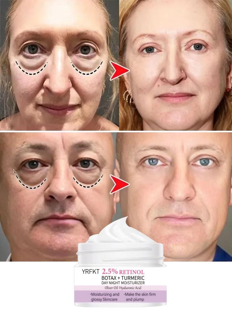 Deep moisturizing eye cream, brightening and eliminating eye puffiness, removing dark circles, wrinkles, anti-aging, and smoothing eye skin 5
Deep moisturizing eye cream, brightening and eliminating eye puffiness, removing dark circles, wrinkles, anti-aging, and smoothing eye skin 5