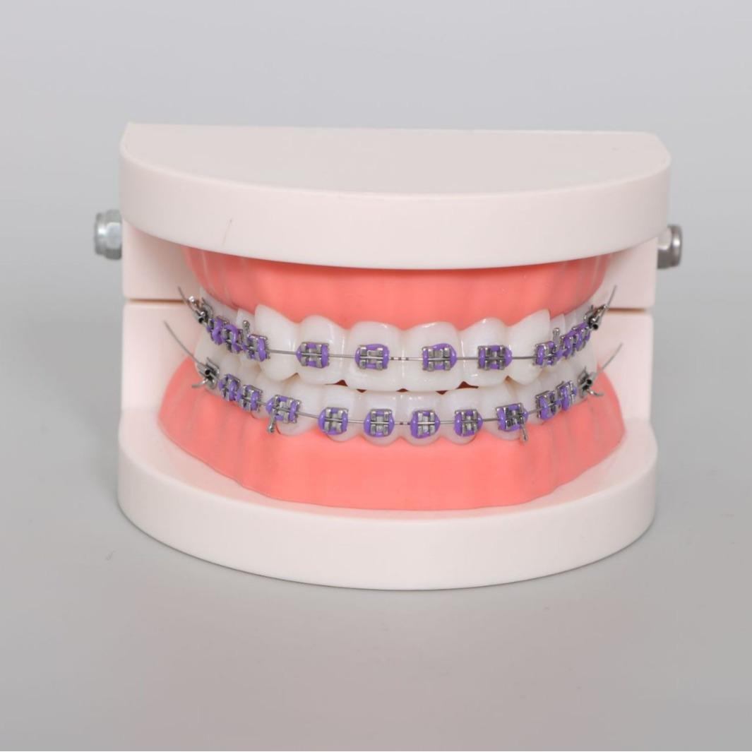 1 шт. Модель зубов для ортодонтического лечения с брекетами, дугой, щечной трубкой, лигатурными лигатурами, модель зуба для стоматологической лаборатории, учебные инструменты белый
1 шт. Модель зубов для ортодонтического лечения с брекетами, дугой, щечной трубкой, лигатурными лигатурами, модель зуба для стоматологической лаборатории, учебные инструменты белый