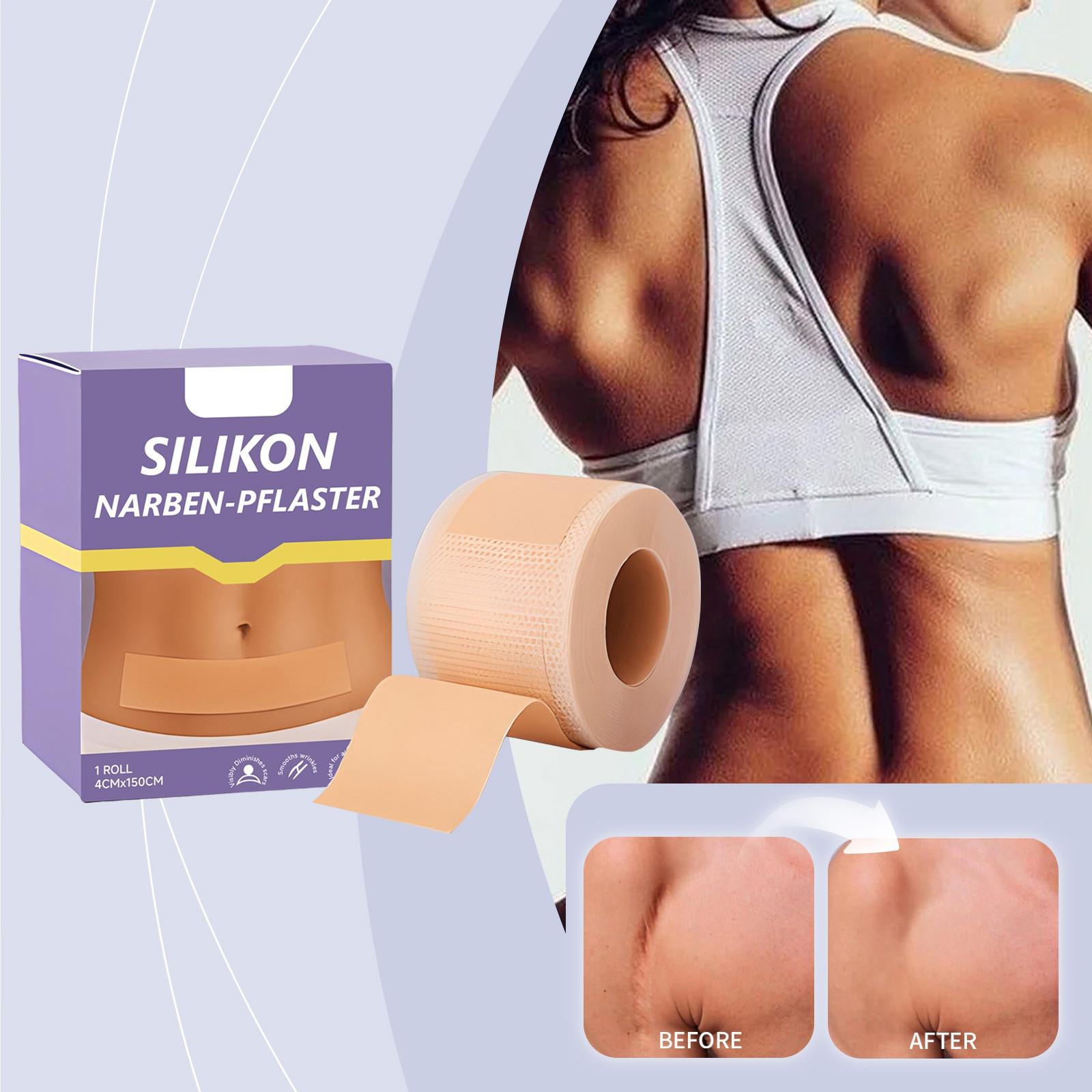 Scar Soothing Patch, Anti-itching, Scar Hyperplasia, Scar Lightening Gel, Light And Breathable, Fits The Skin. фиолетовый
Scar Soothing Patch, Anti-itching, Scar Hyperplasia, Scar Lightening Gel, Light And Breathable, Fits The Skin. фиолетовый