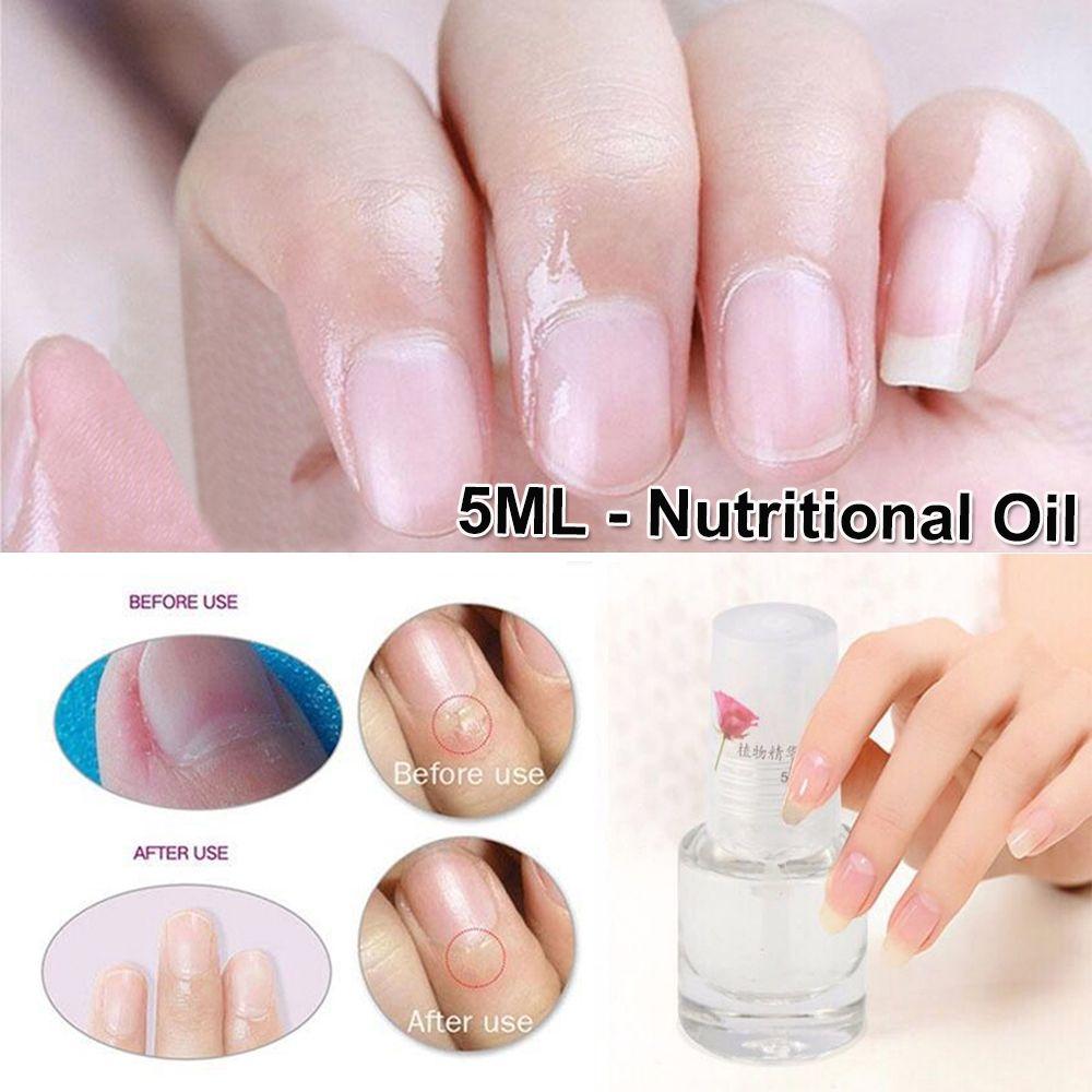 Revitalizer Nail Polish Nail Cuticle Treatment Nail Oil Cuticle Oil Nutritious Oil Base Coat різнокольоровий
Revitalizer Nail Polish Nail Cuticle Treatment Nail Oil Cuticle Oil Nutritious Oil Base Coat різнокольоровий