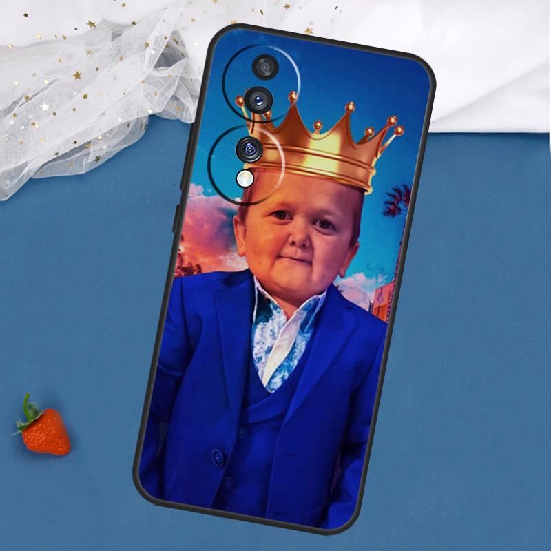 Funny Hasbulla Case For Honor Magic 7 5 6 Lite 8 Pro 200 400 50 70 90 X8c X8b X9a X9b X9c X9d Win RT Cover Honor 70
Funny Hasbulla Case For Honor Magic 7 5 6 Lite 8 Pro 200 400 50 70 90 X8c X8b X9a X9b X9c X9d Win RT Cover Honor 70