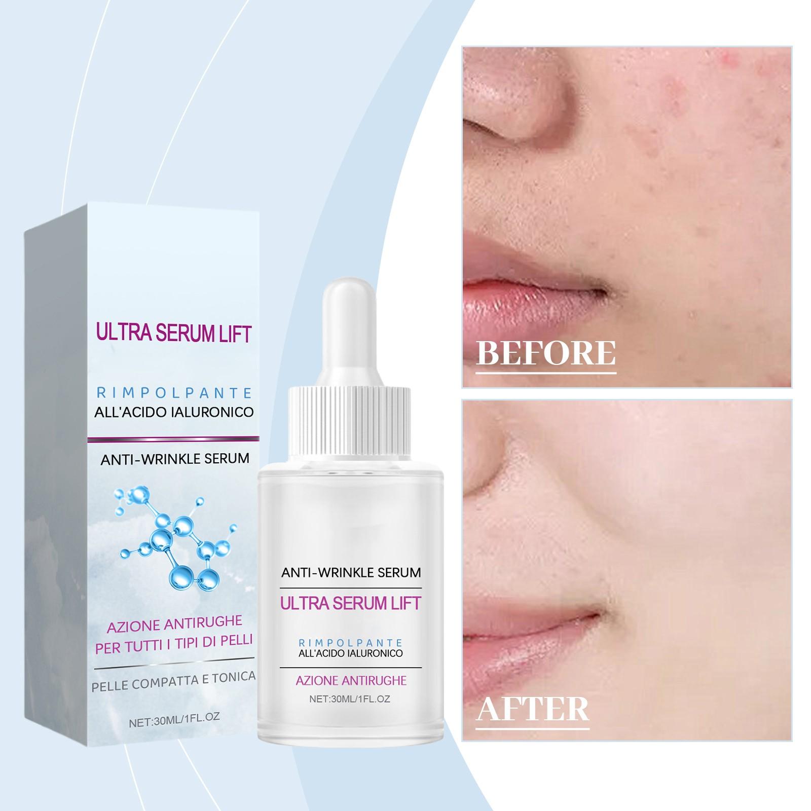 Hyaluronic -wrinkle Deeply Hydrates, Tightens, Rejuvenates The Skin, Brightens The Complexion, Locks In Moisture, Relieves Dryness And Fades Sp 30ML One Size
Hyaluronic -wrinkle Deeply Hydrates, Tightens, Rejuvenates The Skin, Brightens The Complexion, Locks In Moisture, Relieves Dryness And Fades Sp 30ML One Size