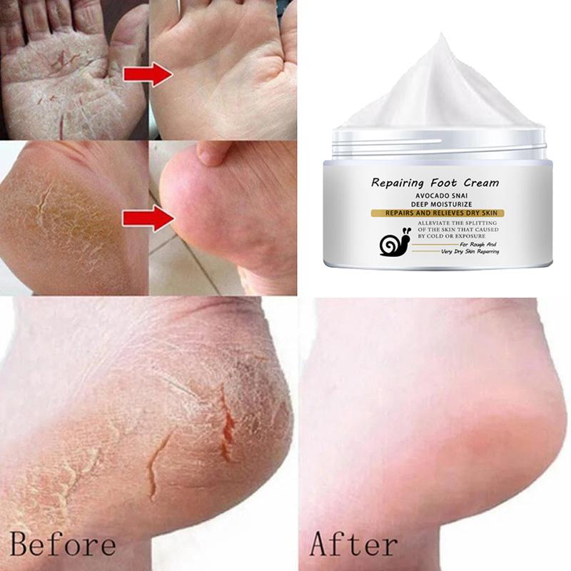 Крем для ног Repair Foot Cream для потрескавшихся, сломанных рук/пяток, натуральный крем-эссенция, нежный и не раздражающий 5g
Крем для ног Repair Foot Cream для потрескавшихся, сломанных рук/пяток, натуральный крем-эссенция, нежный и не раздражающий 5g