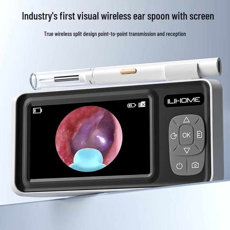 ITIMO Professional HD Visual Ear Endoscope Earwax Removal Kit T65-Y9-EAR
ITIMO Professional HD Visual Ear Endoscope Earwax Removal Kit T65-Y9-EAR