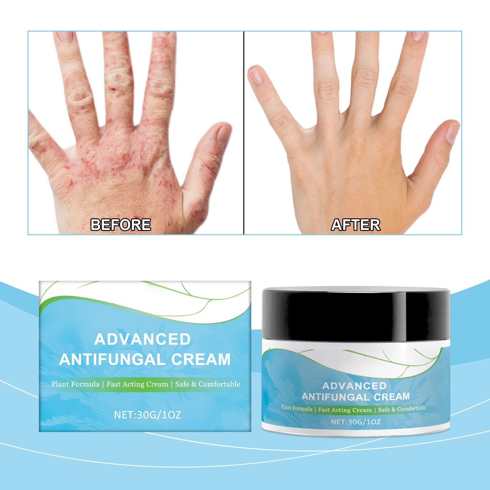 Skin Repair - Крем Питает Кожу, Ежедневный Уход, Местное Применение, Деликатный Крем Для Ухода За Кожей чёрный
Skin Repair - Крем Питает Кожу, Ежедневный Уход, Местное Применение, Деликатный Крем Для Ухода За Кожей чёрный
