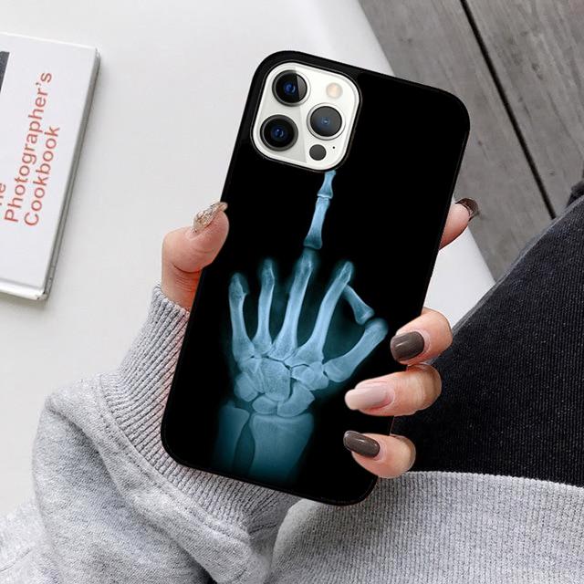 X Ray Veterinary Medicine Phone Case Back Cover for iPhone 17 Air 16 15 14 13 11 12 Pro Max PlusS Shell Coque iPhone 13
X Ray Veterinary Medicine Phone Case Back Cover for iPhone 17 Air 16 15 14 13 11 12 Pro Max PlusS Shell Coque iPhone 13
