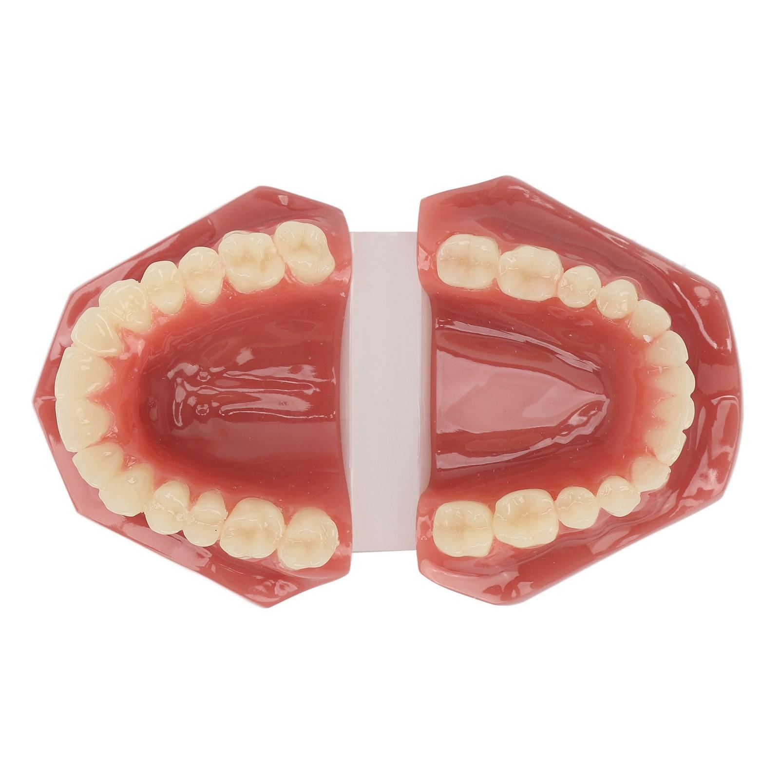 Tooth Model 28 Teeth Dental Orthodontic Model Teaching Study Supplies Dental Demonstration
Tooth Model 28 Teeth Dental Orthodontic Model Teaching Study Supplies Dental Demonstration