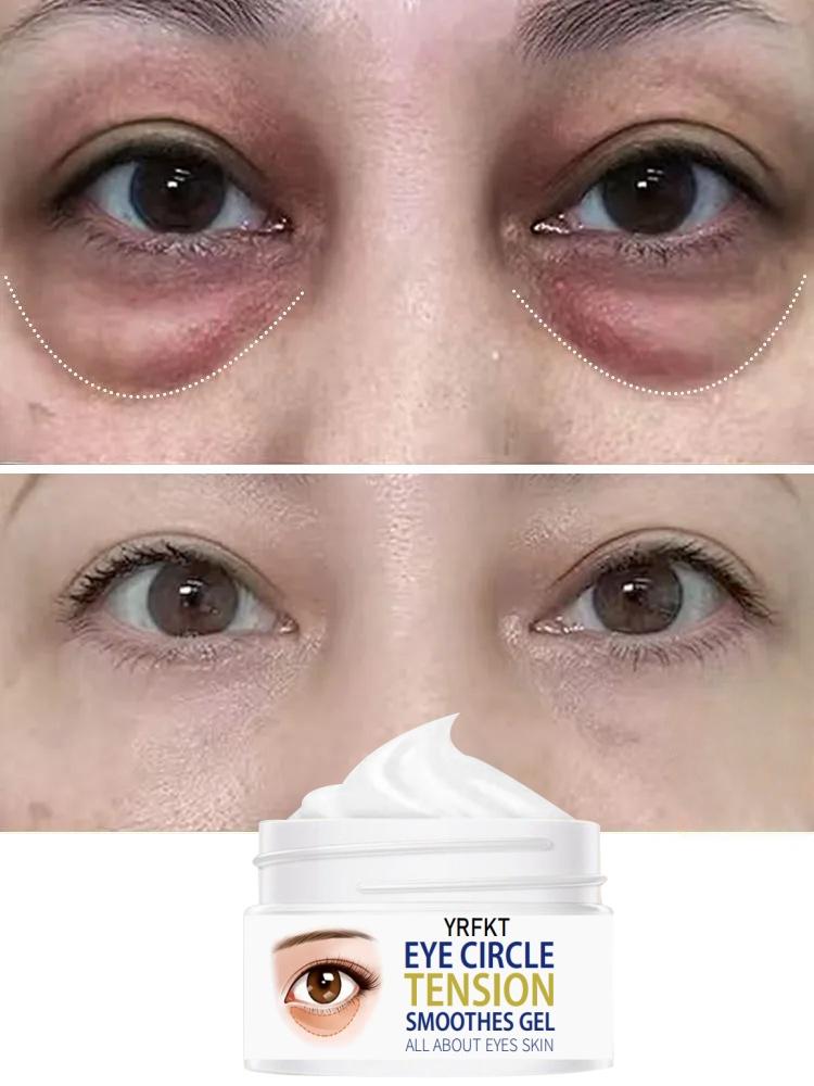 Eye cream can quickly improve eye problems, effectively remove wrinkles, anti-aging, remove dark circles, and eliminate eye puffiness 5
Eye cream can quickly improve eye problems, effectively remove wrinkles, anti-aging, remove dark circles, and eliminate eye puffiness 5