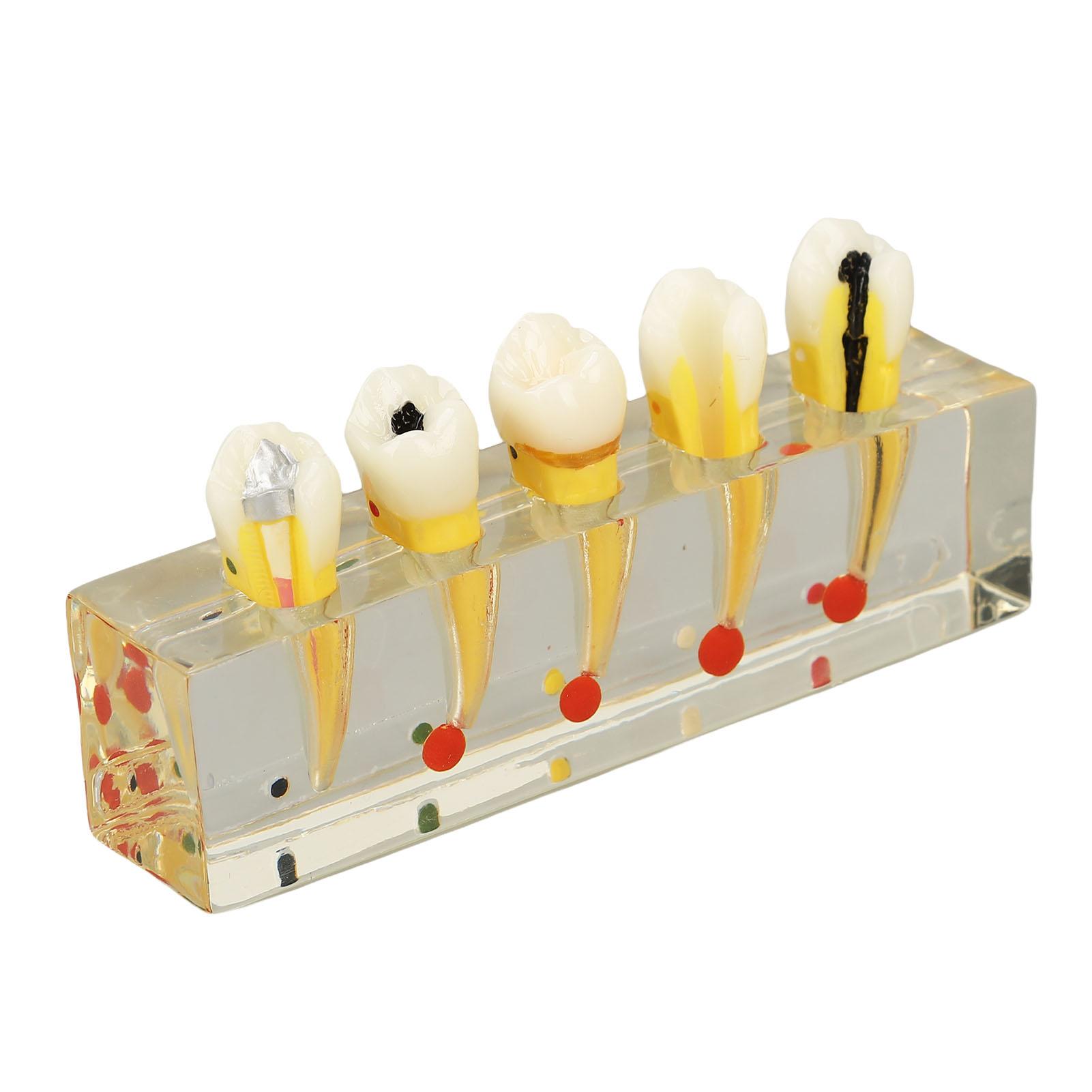 Модель зубов. Прозрачный имплантат. Модель кариеса зубов для стоматологического обучения.
Модель зубов. Прозрачный имплантат. Модель кариеса зубов для стоматологического обучения.