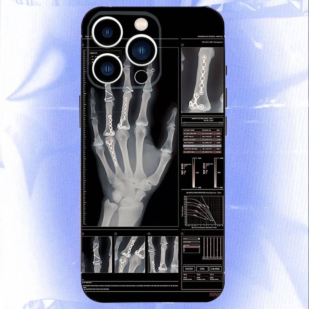 Медицинский Чехол для Телефона с Анатомией Человека Для iPhone 17,16,15,14,13,12,11,Pro,XS,Max,XR,Plus,E,SE4,Mini Черный Мягкий Чехол iPhone17Promax
Медицинский Чехол для Телефона с Анатомией Человека Для iPhone 17,16,15,14,13,12,11,Pro,XS,Max,XR,Plus,E,SE4,Mini Черный Мягкий Чехол iPhone17Promax