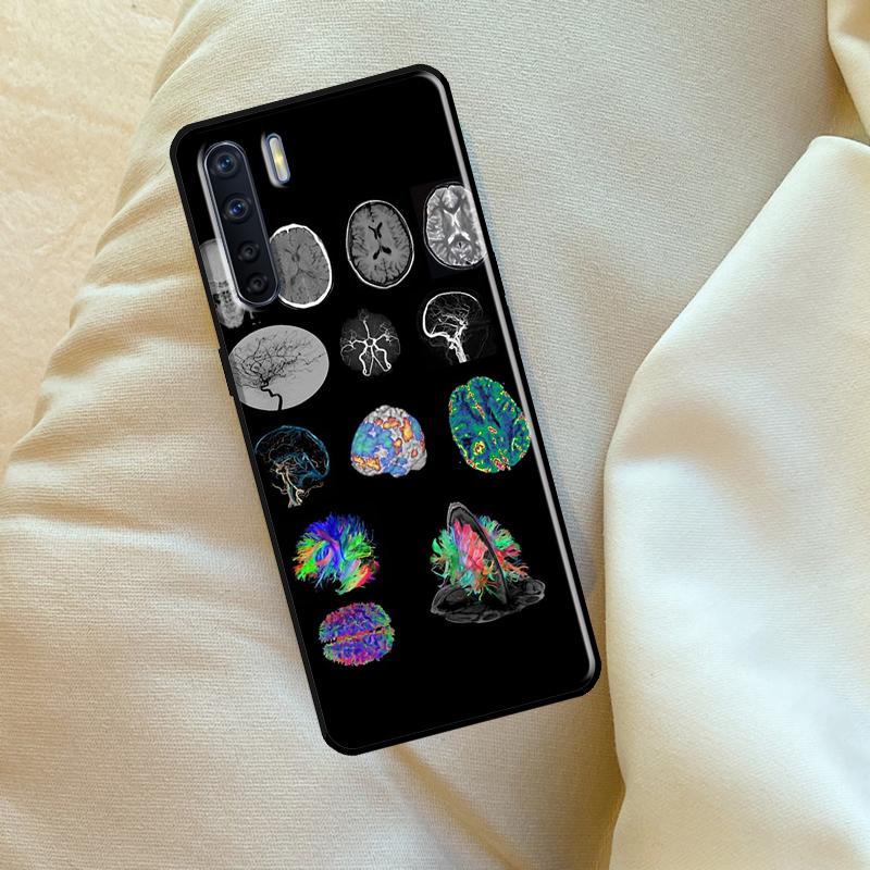 Anatomy Brain Case For Oppo A6 A5 Pro A15 A57 A17 A54 A74 A94 A76 A16 A96 A40 A60 A80 A18 A38 A58 A78 A98 OPPO A58 4G
Anatomy Brain Case For Oppo A6 A5 Pro A15 A57 A17 A54 A74 A94 A76 A16 A96 A40 A60 A80 A18 A38 A58 A78 A98 OPPO A58 4G