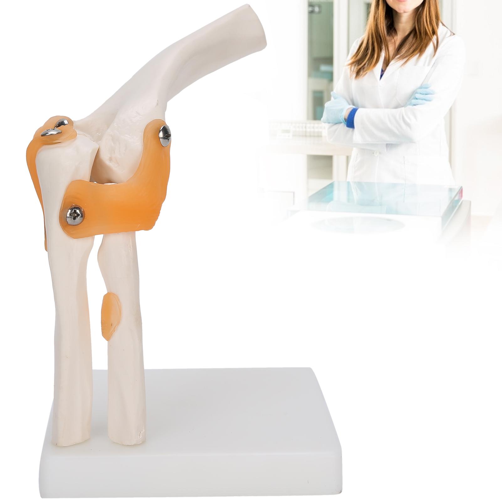 Elbow Joint Model Life Size Accurate Elbow Skeleton Model for Study Display Teaching
Elbow Joint Model Life Size Accurate Elbow Skeleton Model for Study Display Teaching